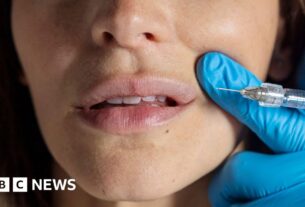 A IA Tool colocou para testar as opiniões do público sobre Botox e enchimentos