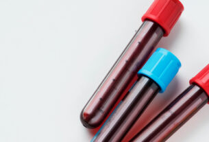 EUA aprovam uso de exame sanguíneo para detectar Alzheimer