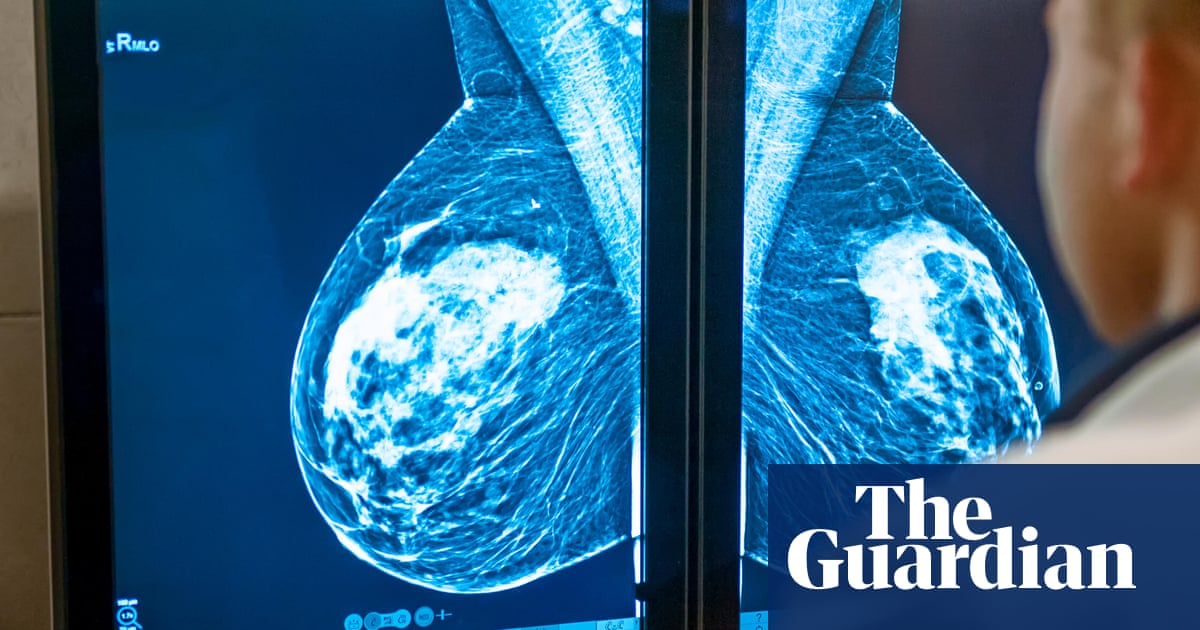 O NHS deu às empresas privadas recorde de £ 216m para examinar os radiografias em 2024 | NHS