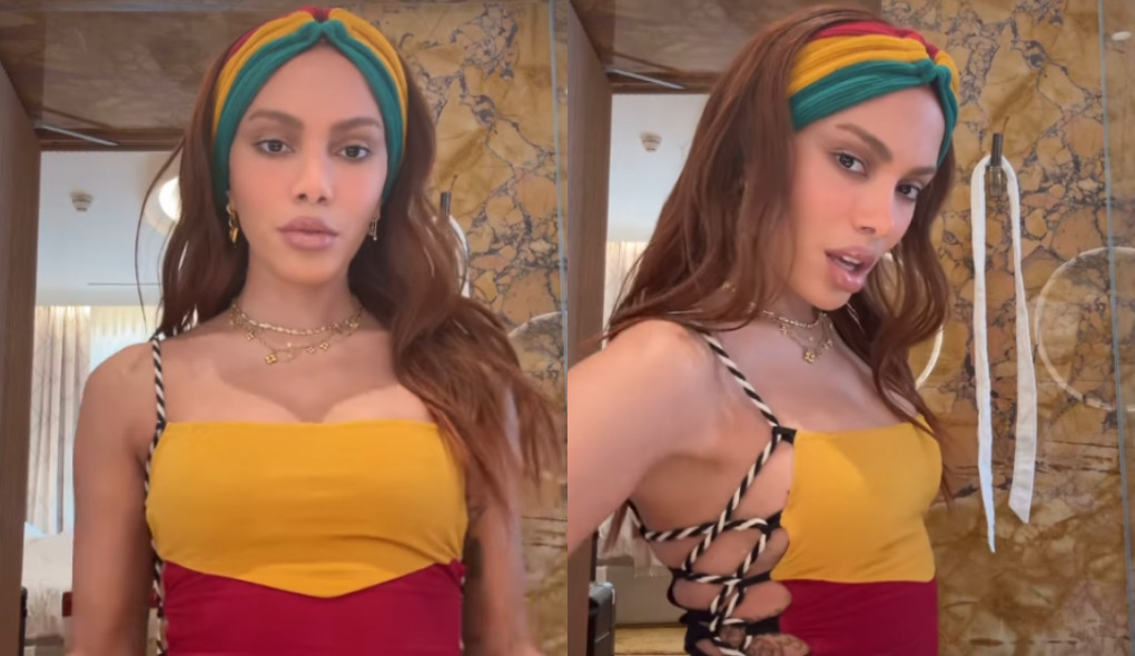 Anitta reaparece após procedimento estético e web comenta nova aparência: ‘outra pessoa’