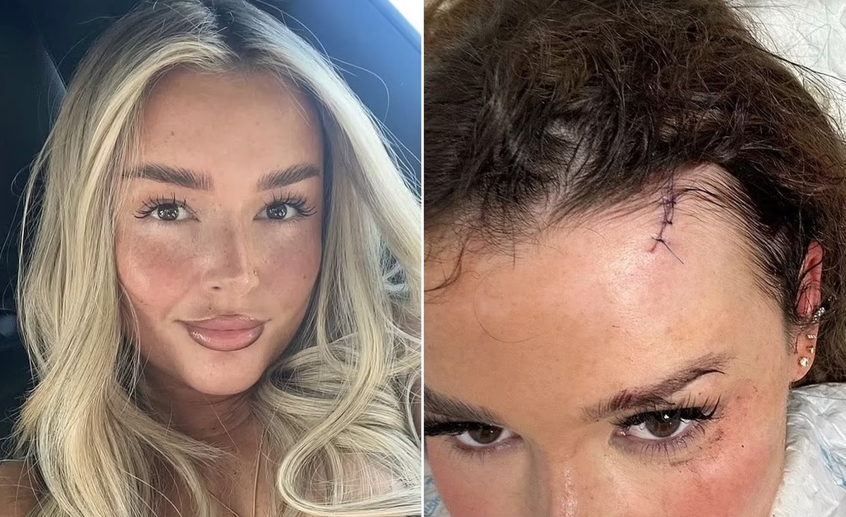 Influencer atacada por stalker quando fazia selfies para postagem na web ainda é alvo nas redes: 'Merecia mais'
