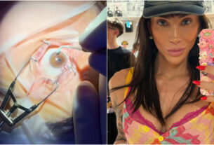 Mudar a cor dos olhos como Maya Massafera é sonho estético ou risco à visão?