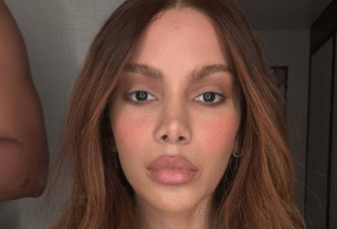 Anitta fala pela primeira vez sobre novos procedimentos estéticos: ‘O corpo é meu’