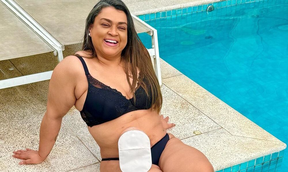 Câncer de intestino, que matou Preta Gil, está em alta em adultos com até 50 anos