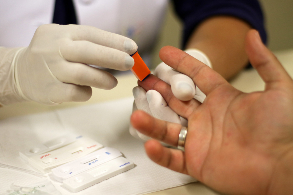 Casos de hepatite A no Brasil aumentam 54,5% em 2024