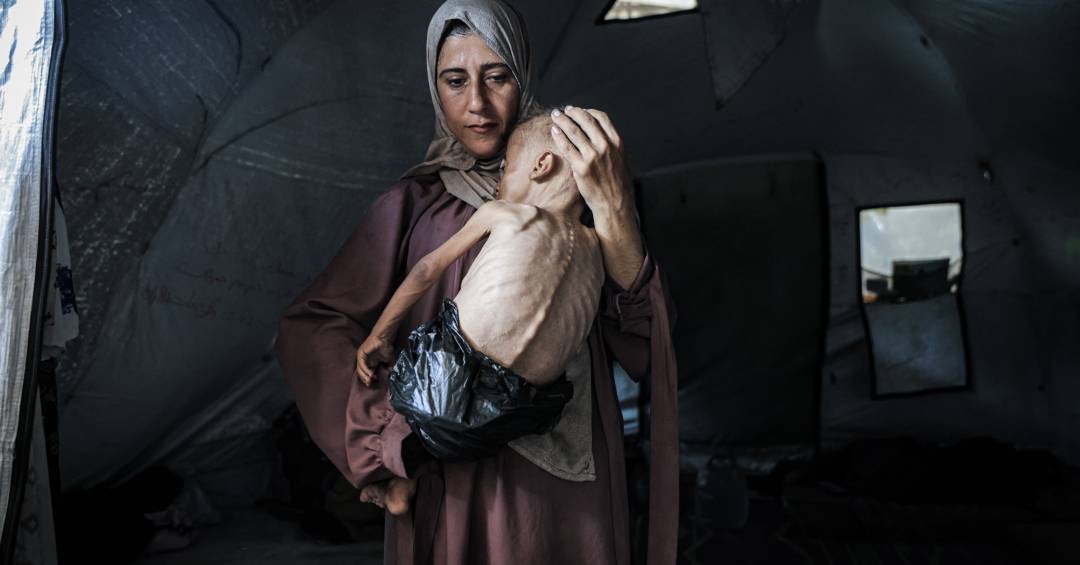 Desnutrição entre menores de 5 anos triplicou em Gaza nas últimas semanas, diz MSF