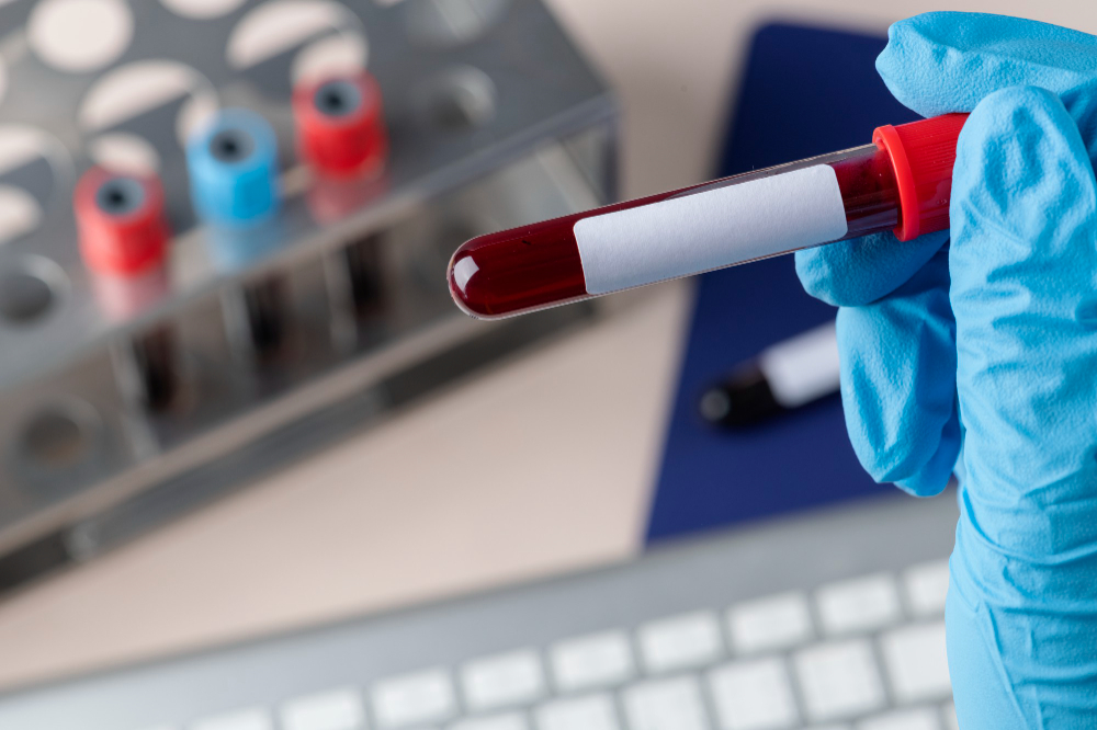 Exames de sangue revolucionam o diagnóstico precoce de doenças complexas