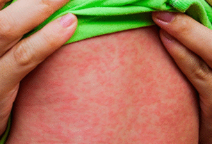 Governo de SP reforça alerta para vacinação contra sarampo com início das férias escolares