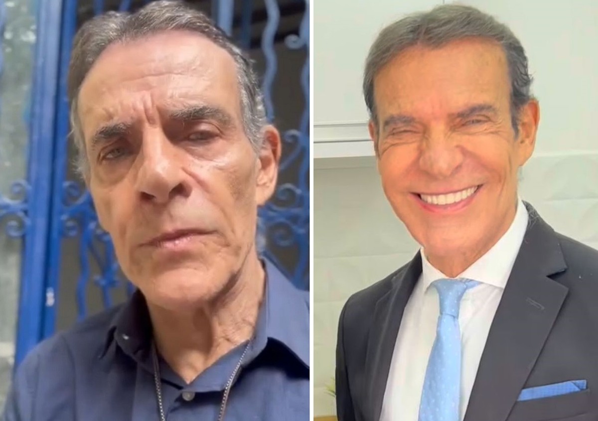 Mário Gomes recorre à harmonização facial aos 72 anos e exibe novo visual