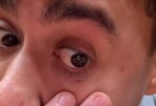 Nikolas Ferreira sai sangrando de tumulto com Bolsonaro na Câmara